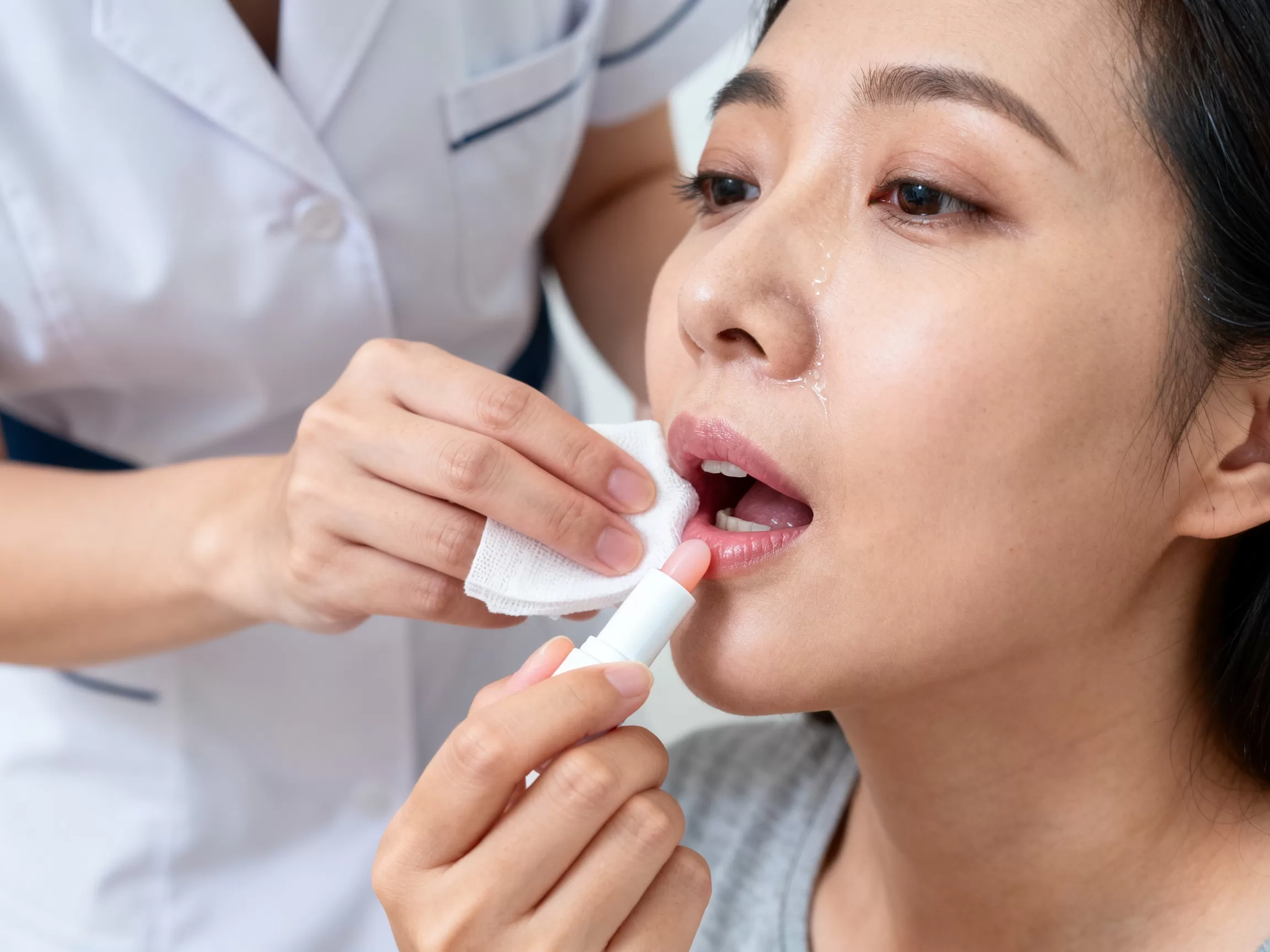 胸腔结核患者用完激素吸入器嘴巴发黏咋护理，护理要点有哪些