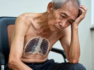 胸腔结核乏力没精神咋办，怎么快速缓解？